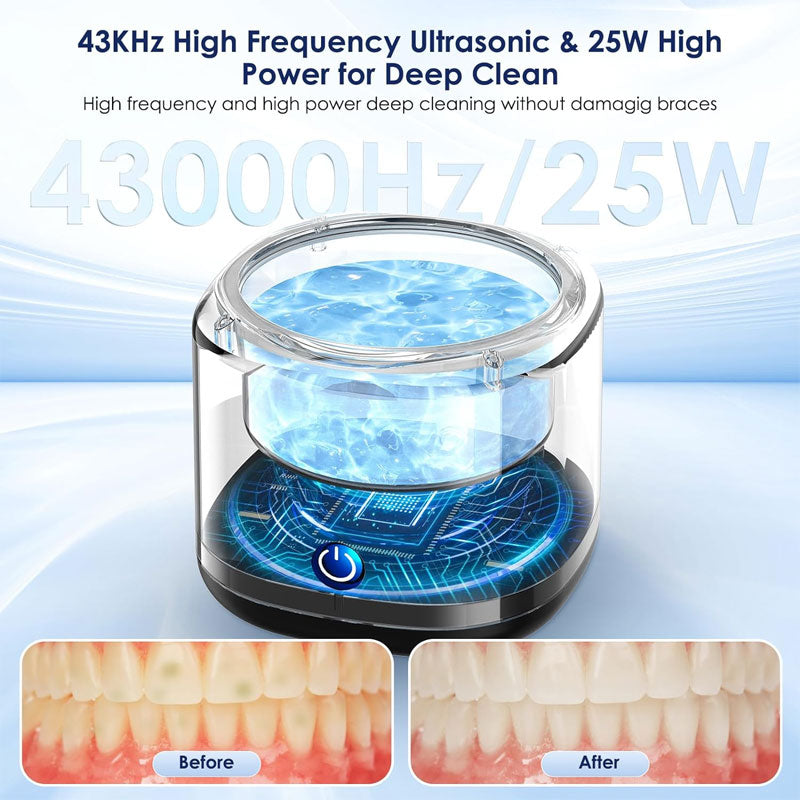 Ultrasonic Braces Cleaner